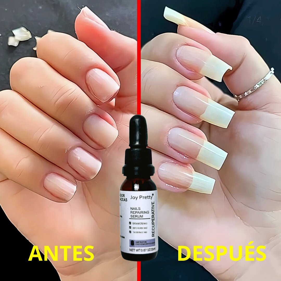 NAIL GROWTH X2 UND (CARRITO) MCF